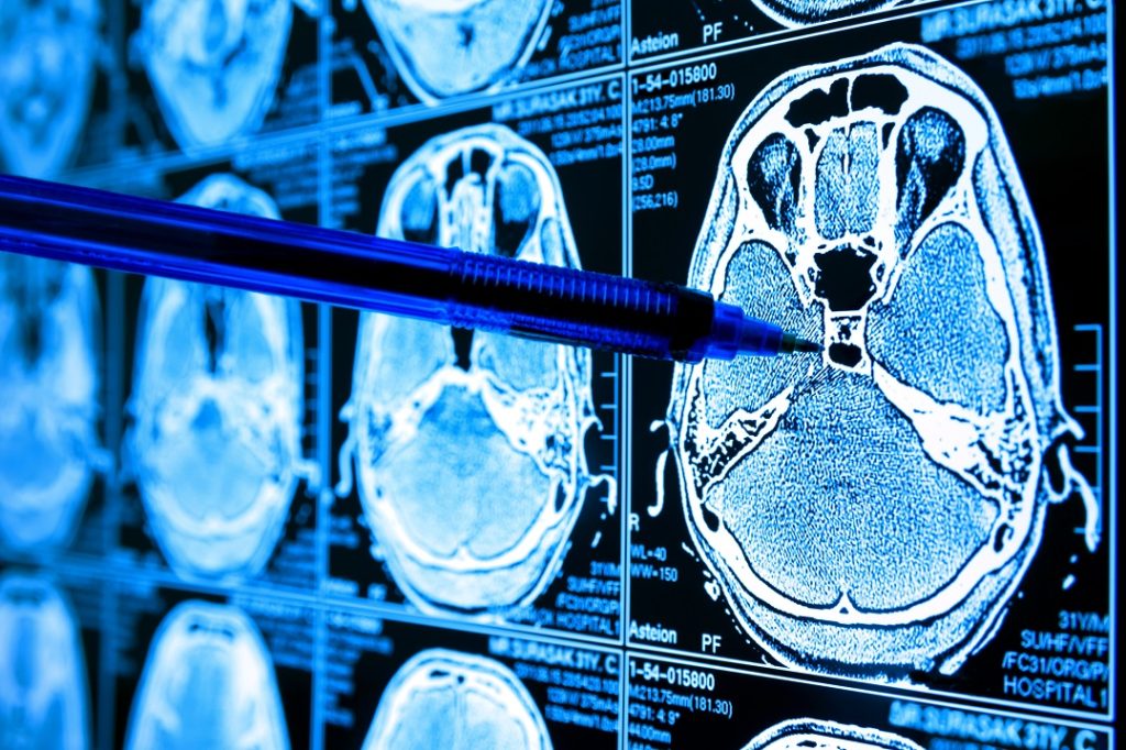 ¡Novedad! Inteligencia Artificial aprende a identificar con precisión el cáncer