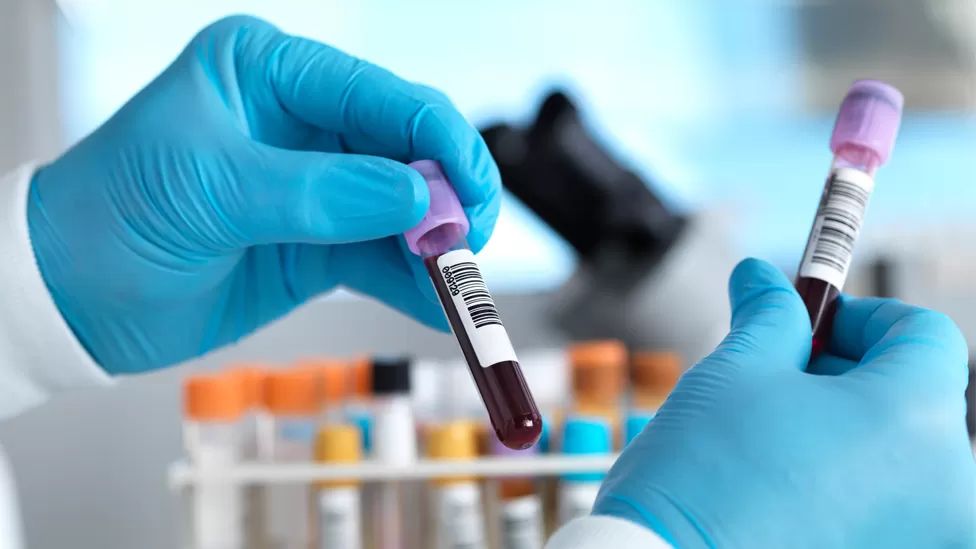Avance científico: una muestra de sangre podría permitir desarrollar tratamientos personalizados contra el cáncer